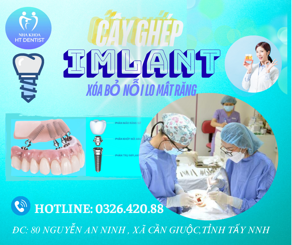 Trồng răng implant
