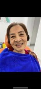 Tháo Lắp Răng - Nụ Cười Tự Tin Của Khách Hàng